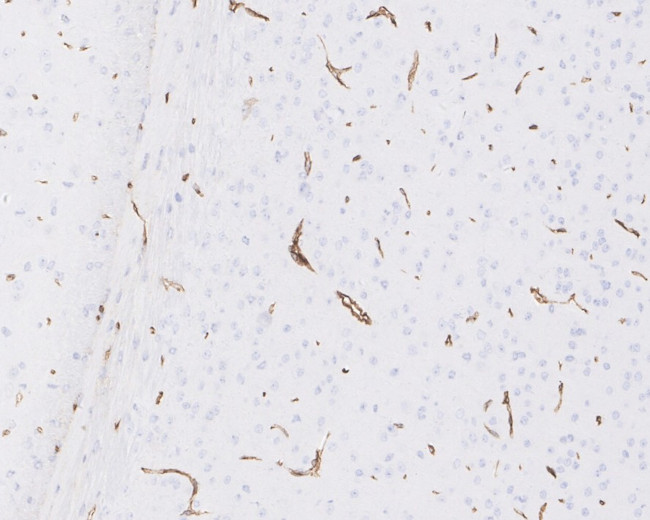 AHNAK Antibody in Immunohistochemistry (Paraffin) (IHC (P))