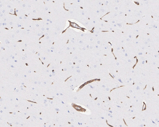 AHNAK Antibody in Immunohistochemistry (Paraffin) (IHC (P))