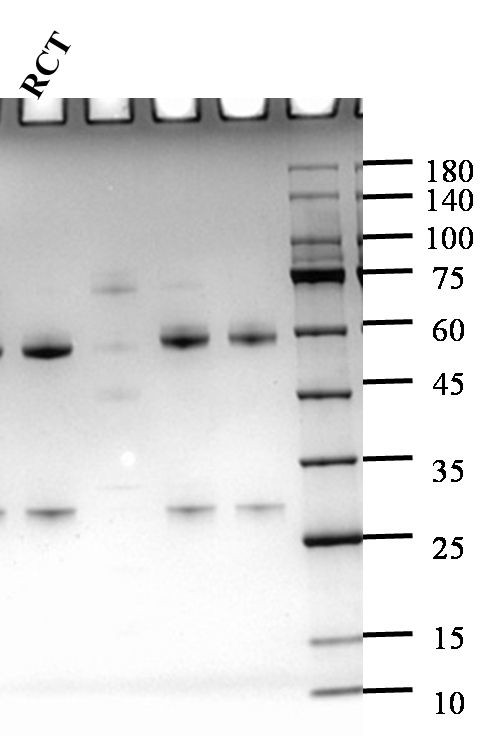 Ractopamine Antibody in SDS-PAGE (SDS-PAGE)