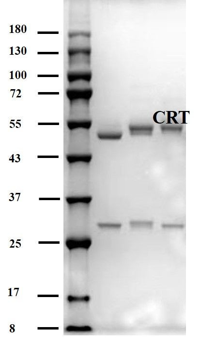 Cortisol Antibody in SDS-PAGE (SDS-PAGE)