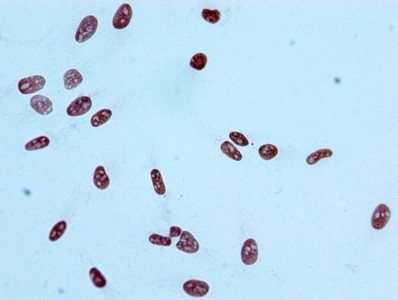 H2AK9ac (type 1-B/E) Antibody in Immunocytochemistry (ICC/IF)