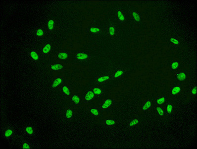 H2AK9ac (type 1-B/E) Antibody in Immunocytochemistry (ICC/IF)