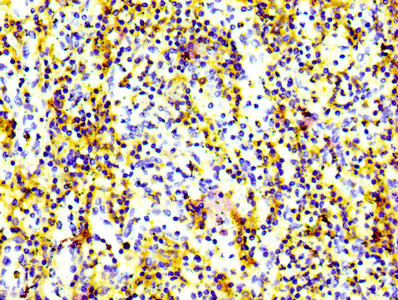 CD97 Antibody in Immunohistochemistry (Paraffin) (IHC (P))