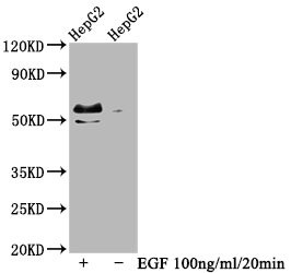 Phospho-c-Myc (Thr58, Ser62) Antibody in Western Blot (WB)