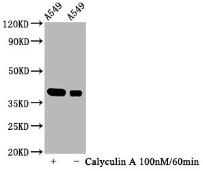 Phospho-IkB alpha (Ser32) Antibody in Western Blot (WB)