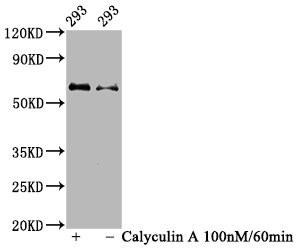 Phospho-AKT1 (Ser473) Antibody in Western Blot (WB)