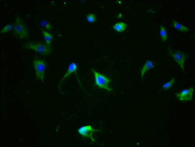 Phospho-Tau (Ser324) Antibody in Immunocytochemistry (ICC/IF)