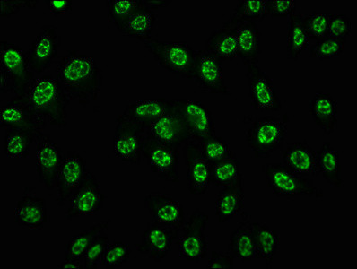 Phospho-CREB (Ser133) Antibody in Immunocytochemistry (ICC/IF)