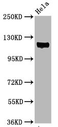 Phospho-FAK (Tyr397) Antibody in Western Blot (WB)