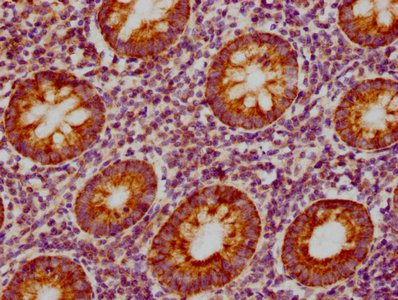 MIP-3 beta Antibody in Immunohistochemistry (Paraffin) (IHC (P))