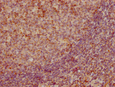 MIP-3 beta Antibody in Immunohistochemistry (Paraffin) (IHC (P))