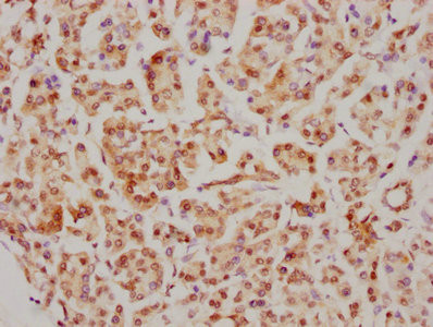 Cdc5L Antibody in Immunohistochemistry (Paraffin) (IHC (P))