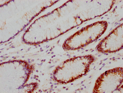 Carbonic Anhydrase IX Antibody in Immunohistochemistry (Paraffin) (IHC (P))