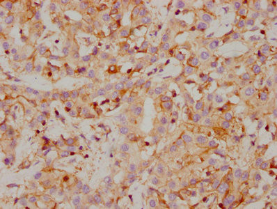 Carbonic Anhydrase IX Antibody in Immunohistochemistry (Paraffin) (IHC (P))