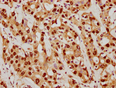 SUMO1 Antibody in Immunohistochemistry (Paraffin) (IHC (P))