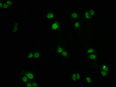 FOXO3A Antibody in Immunocytochemistry (ICC/IF)