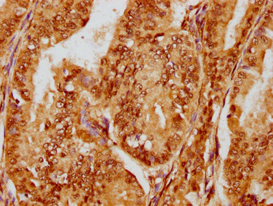 FOXO3A Antibody in Immunohistochemistry (Paraffin) (IHC (P))