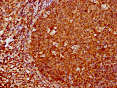 FOXO3A Antibody in Immunohistochemistry (Paraffin) (IHC (P))