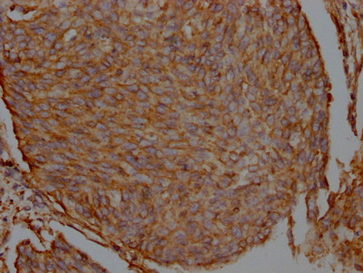 Filamin A Antibody in Immunohistochemistry (Paraffin) (IHC (P))