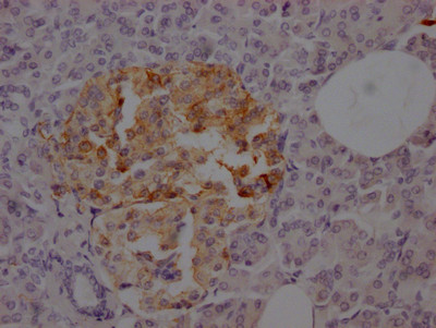 SSTR2 Antibody in Immunohistochemistry (Paraffin) (IHC (P))