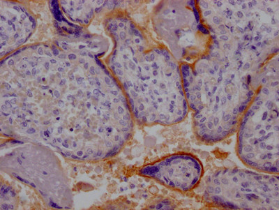 5T4 Antibody in Immunohistochemistry (Paraffin) (IHC (P))