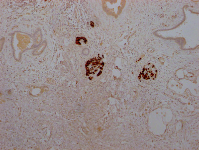 Insulin Antibody in Immunohistochemistry (Paraffin) (IHC (P))