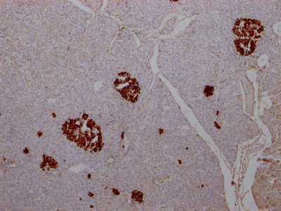 Insulin Antibody in Immunohistochemistry (Paraffin) (IHC (P))