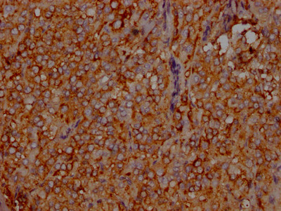 LDLR Antibody in Immunohistochemistry (Paraffin) (IHC (P))