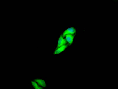 c-Met Antibody in Immunocytochemistry (ICC/IF)