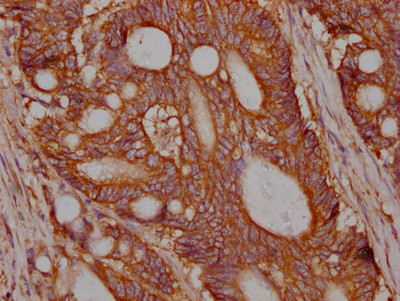 c-Met Antibody in Immunohistochemistry (Paraffin) (IHC (P))