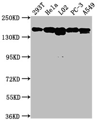 c-Met Antibody in Western Blot (WB)