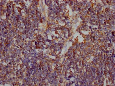 GLUT1 Antibody in Immunohistochemistry (Paraffin) (IHC (P))