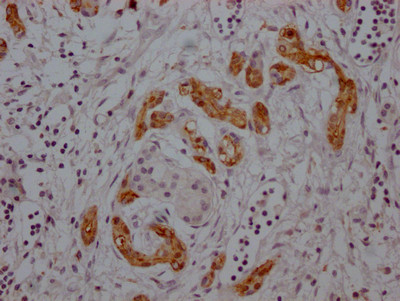 Midkine Antibody in Immunohistochemistry (Paraffin) (IHC (P))