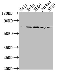 PRMT5 Antibody in Western Blot (WB)