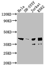 ISL1 Antibody in Western Blot (WB)