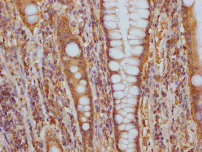 CD51 Antibody in Immunohistochemistry (Paraffin) (IHC (P))