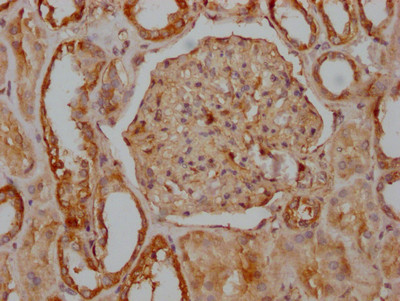 CD51 Antibody in Immunohistochemistry (Paraffin) (IHC (P))