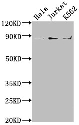 IKK beta Antibody in Western Blot (WB)