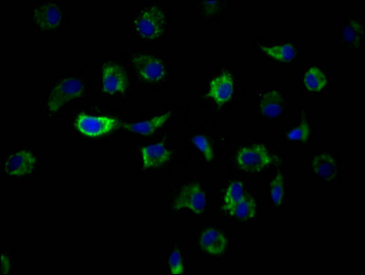 ILK Antibody in Immunocytochemistry (ICC/IF)