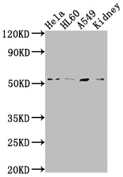 ILK Antibody in Western Blot (WB)