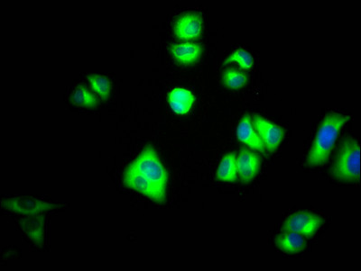 PKM2 Antibody in Immunocytochemistry (ICC/IF)