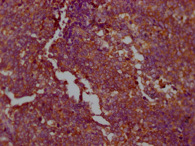 PKM2 Antibody in Immunohistochemistry (Paraffin) (IHC (P))