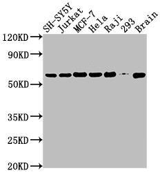 PKM2 Antibody in Western Blot (WB)