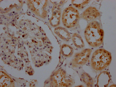 SIRT5 Antibody in Immunohistochemistry (Paraffin) (IHC (P))