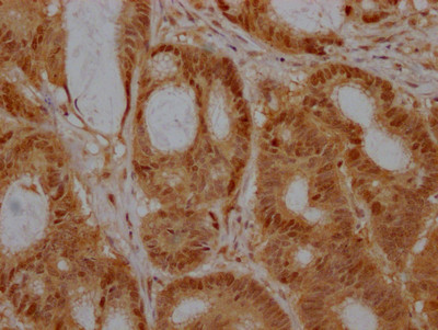 EZH2 Antibody in Immunohistochemistry (Paraffin) (IHC (P))