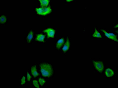 FASN Antibody in Immunocytochemistry (ICC/IF)