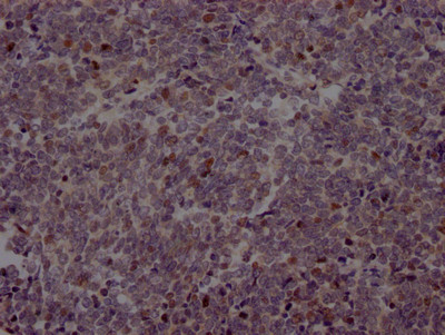 EZH2 Antibody in Immunohistochemistry (Paraffin) (IHC (P))