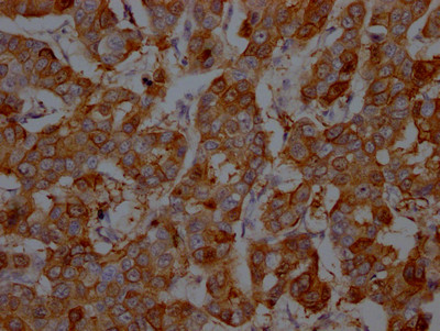 S100A9 Antibody in Immunohistochemistry (Paraffin) (IHC (P))