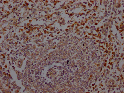 Neutrophil elastase Antibody in Immunohistochemistry (Paraffin) (IHC (P))