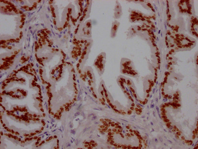 FOXA1 Antibody in Immunohistochemistry (Paraffin) (IHC (P))